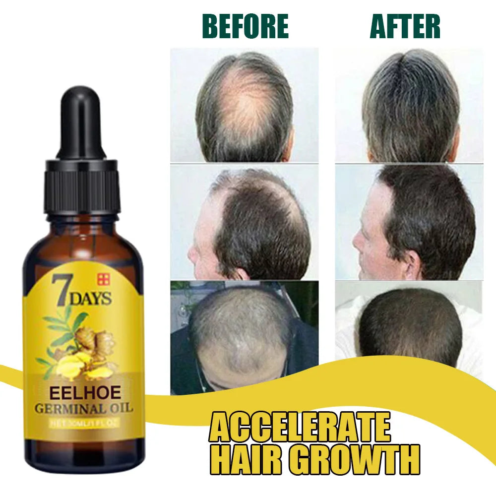 Hair Growth Oil