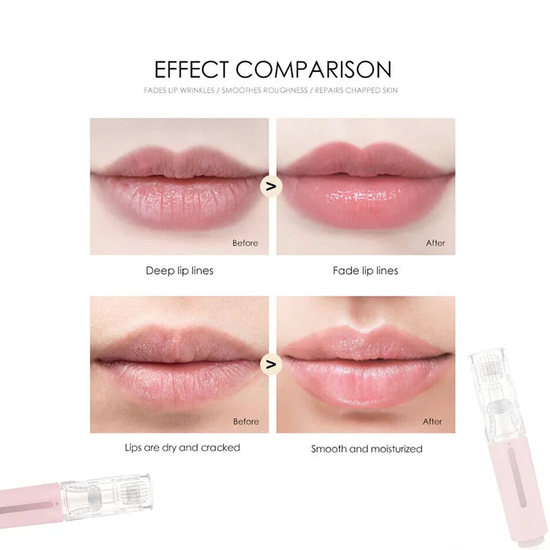 Lip Plumping Kit